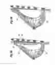 Fig. 04 - Soft filled prosthesis shell with variable texture