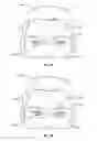 Fig. 08 - Intraocular lens devices, systems, and related methods
