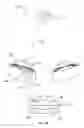 Fig. 02 - Intraocular lens systems and related methods