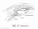 Fig. 04 - Accommodating intraocular lenses