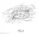Fig. 07 - Accommodating intraocular lenses