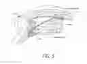 Fig. 08 - Accommodating intraocular lenses