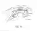 Fig. 15 - Accommodating intraocular lenses