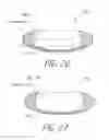 Fig. 31 - Accommodating intraocular lenses
