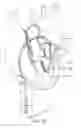 Fig. 22 - Repositionable endoluminal support structure and its applications