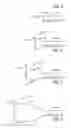 Fig. 03 - Stentless support structure