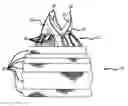 Fig. 01 - Stentless support structure