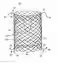 Fig. 01 - Replacement prosthetic heart valve, system and method of implant