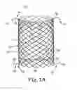 Fig. 02 - Replacement prosthetic heart valve, system and method of implant