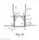 Fig. 07 - Replacement prosthetic heart valve, system and method of implant