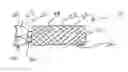 Fig. 01 - Low-profile prosthetic valve structure