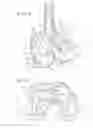 Fig. 04 - Femoral implant systems