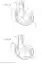 Fig. 08 - Femoral implant systems