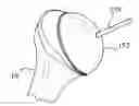 Fig. 01 - Shoulder arthroplasty system with combination humeral sizer, trial, and guide