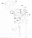 Fig. 01 - Length/offset reproducing device for total hip arthroplasty