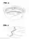 Fig. 03 - Acetabular cup assembly for multiple bearing materials