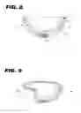 Fig. 05 - Acetabular cup assembly for multiple bearing materials