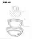 Fig. 11 - Acetabular cup assembly for multiple bearing materials