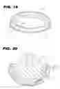 Fig. 12 - Acetabular cup assembly for multiple bearing materials