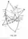 Fig. 28 - Articulated commissure valve stents and methods