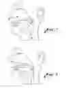 Fig. 02 - ORAL APPLIANCE