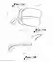 Fig. 08 - ORAL APPLIANCE
