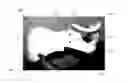 Fig. 01 - Cervical collar