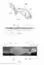 Fig. 04 - Cervical collar
