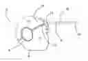 Fig. 01 - Ocular drainage device and method of manufacturing thereof