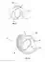 Fig. 04 - Ocular drainage device and method of manufacturing thereof