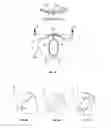 Fig. 05 - Ocular drainage device and method of manufacturing thereof