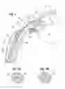 Fig. 02 - Glaucoma drainage shunts and methods of use