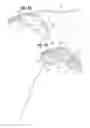Fig. 03 - Glaucoma drainage shunts and methods of use