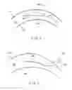 Fig. 04 - Method and apparatus for precision working of material