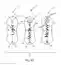 Fig. 15 - ABSORBENT ARTICLE HAVING A FUNCTIONAL ENHANCEMENT INDICATOR