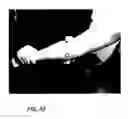 Fig. 43 - Method for Treating and Correcting Gait Related Joint Dysfunctions