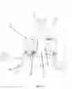 Fig. 02 - Neonatal chest splint for applying negative distending pressure