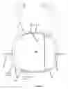 Fig. 04 - Neonatal chest splint for applying negative distending pressure