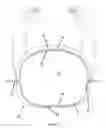 Fig. 06 - Neonatal chest splint for applying negative distending pressure