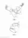 Fig. 02 - Compression device for the foot