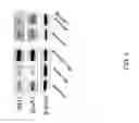 Fig. 05 - Use of negative modulators of GABA receptors containing alpha5 subunits as fast acting antidepressants