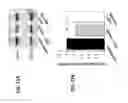 Fig. 12 - Use of negative modulators of GABA receptors containing alpha5 subunits as fast acting antidepressants