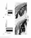 Fig. 02 - METHODS OF TREATING GLAUCOMA USING AMP-ACTIVATED PROTEIN KINASE (AMPK) ACTIVATORS