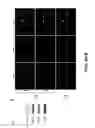 Fig. 04 - METHODS OF TREATING GLAUCOMA USING AMP-ACTIVATED PROTEIN KINASE (AMPK) ACTIVATORS
