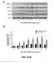 Fig. 05 - METHODS OF TREATING GLAUCOMA USING AMP-ACTIVATED PROTEIN KINASE (AMPK) ACTIVATORS