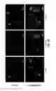 Fig. 13 - METHODS OF TREATING GLAUCOMA USING AMP-ACTIVATED PROTEIN KINASE (AMPK) ACTIVATORS