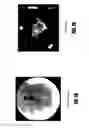 Fig. 08 - PLATELET RICH PLASMA FORMULATIONS