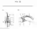 Fig. 33 - IMMUNE BALANCE REGULATOR