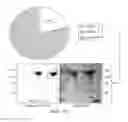 Fig. 04 - Carrier-antibody compositions and methods of making and using the same