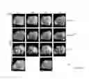 Fig. 19 - Carrier-antibody compositions and methods of making and using the same